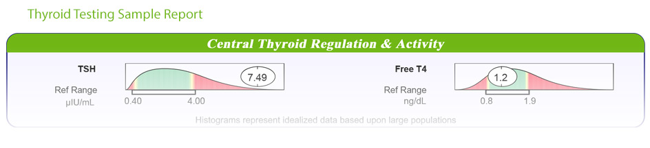 Thyroid Testing Results Sample Report&nbsp;